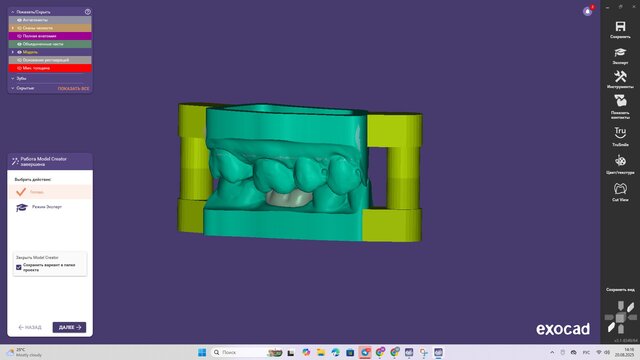 Dental Crown – Digital Model for Milling & 3D Printing