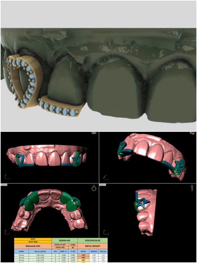 Grillz – image 2 of 2