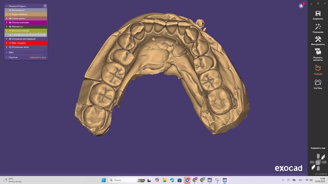 Three Separate Dental Crowns