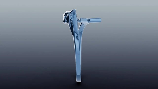 3D model of Sculpted Bypass Dolphin Ring in Vibrant Blue Gold Metal