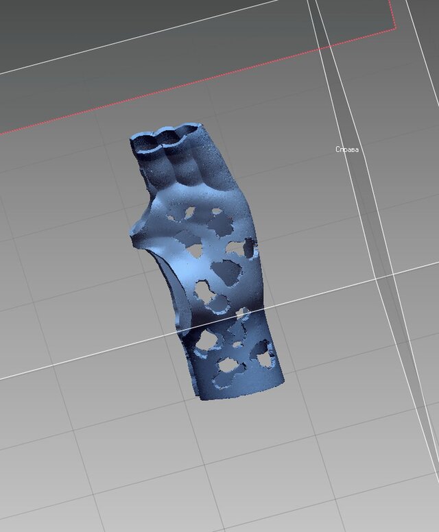 3D model of Custom 3D-Printed Orthosis from 3D Scan for a Child’s Hand (Left Hand)