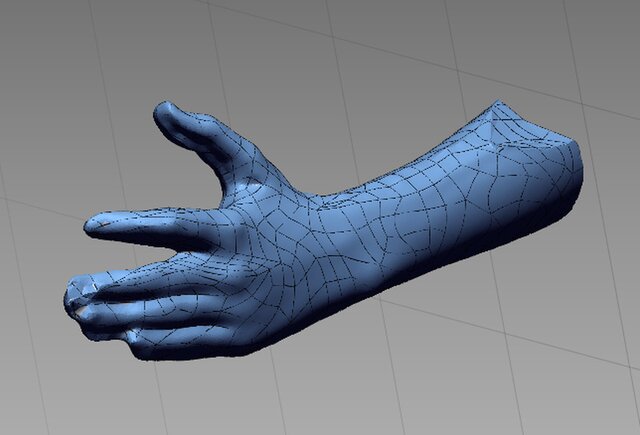 3D model of Custom 3D-Printed Orthosis from 3D Scan for a Child’s Hand (Left Hand)