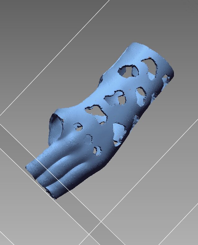 3D model of Custom 3D-Printed Orthosis from 3D Scan for a Child’s Hand (Left Hand)