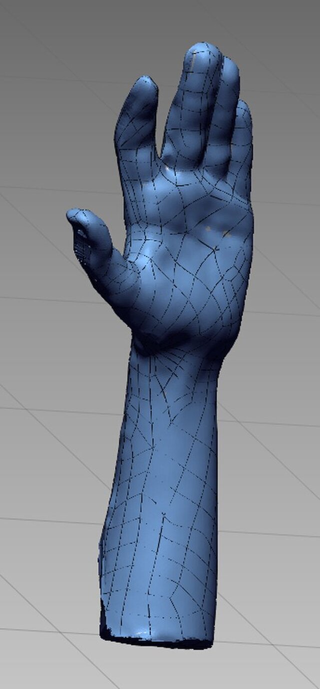 3D model of Custom 3D-Printed Orthosis from 3D Scan for a Child’s Hand (Left Hand)