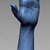 Custom 3D-Printed Orthosis from 3D Scan for a Child’s Hand (Left Hand)