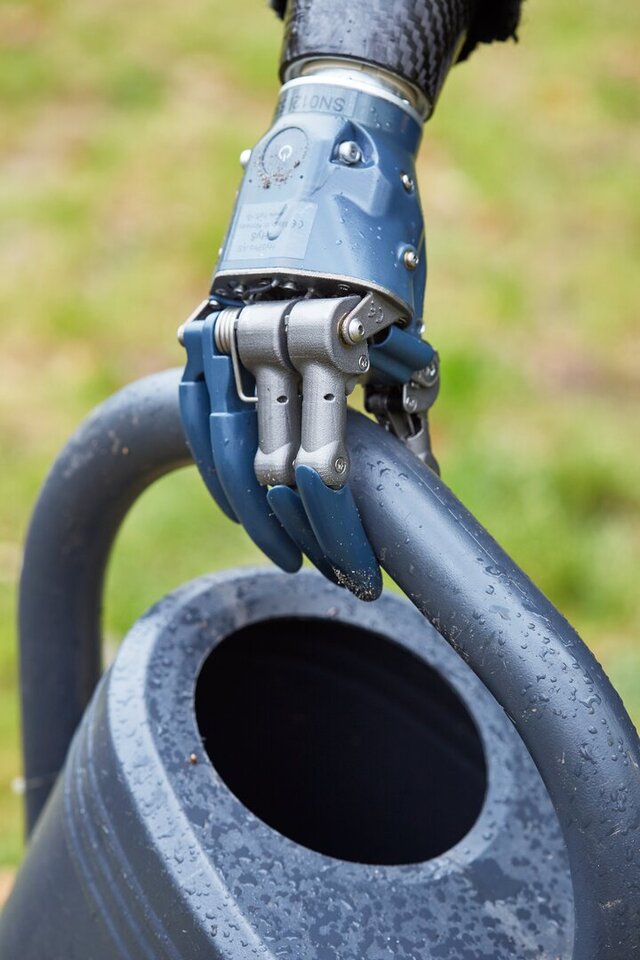 3D model of Hydraulic Hand Prosthesis – From Concept to Commercial Product