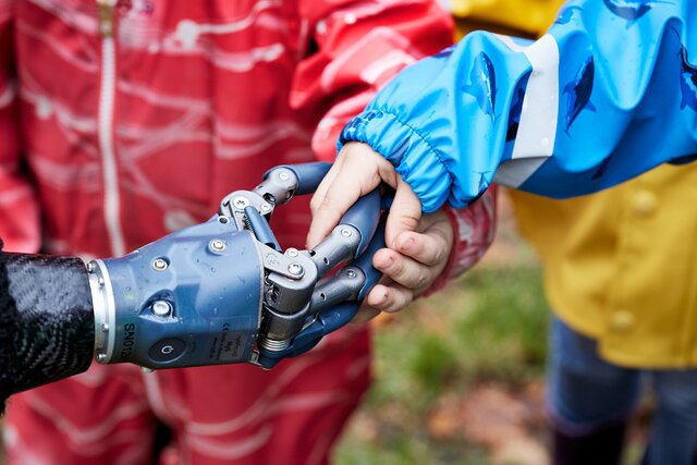 3D model of Hydraulic Hand Prosthesis – From Concept to Commercial Product