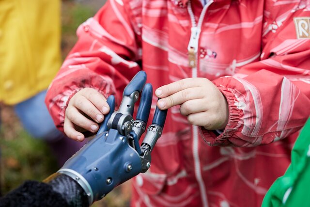 3D model of Hydraulic Hand Prosthesis – From Concept to Commercial Product