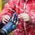 Hydraulic Hand Prosthesis – From Concept to Commercial Product