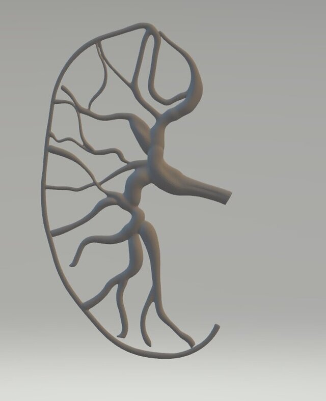 kidney model