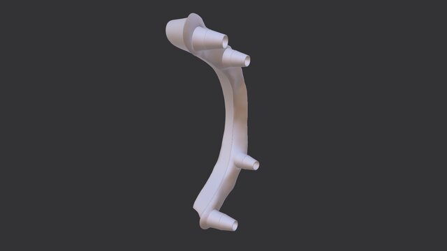 3D model of Ti Bar design