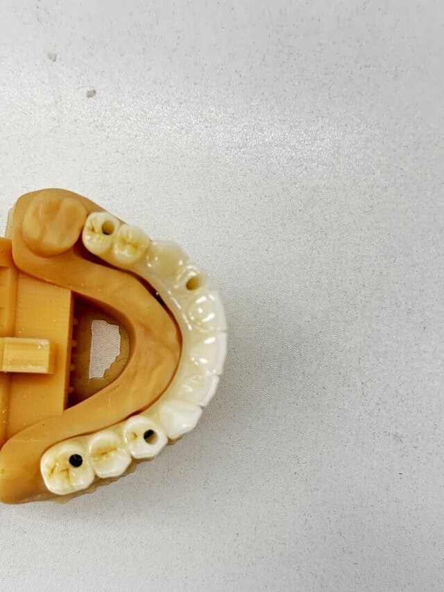 3D model of Ti Bar design