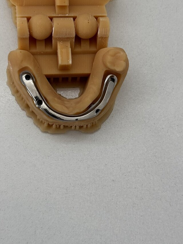 3D model of Ti Bar design