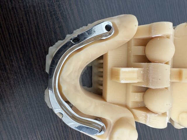 3D model of Ti Bar design