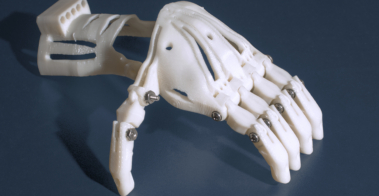 3d printed prosthetics