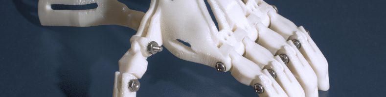 3d printed prosthetics