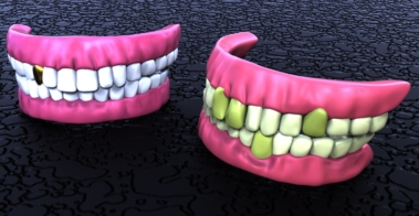 TEETH
