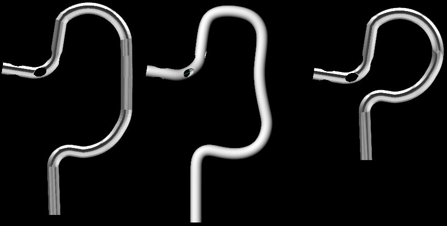 custom-breathing-assistance-mouthpiece