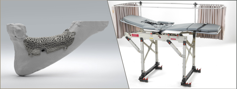 jaw reconstruction and medical bed design by Cad Crowd experts | Cad Crowd jaw reconstruction and medical bed design by Cad Crowd experts