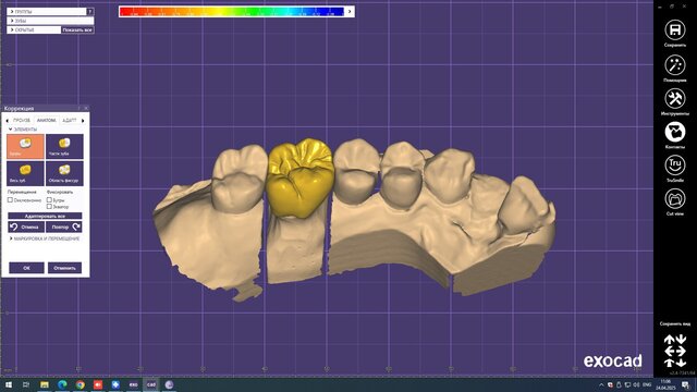 I offer professional dental CAD design (Exocad) for crowns, veneers & implants image 2