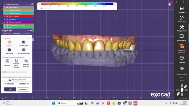 I offer professional dental CAD design (Exocad) for crowns, veneers & implants image 3