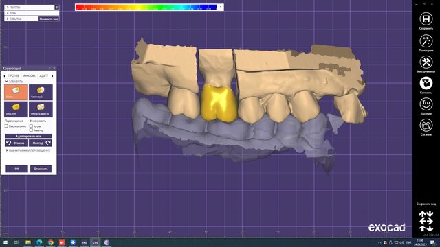 I offer professional dental CAD design (Exocad) for crowns, veneers & implants image 8