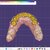 I offer professional dental CAD design (Exocad) for crowns, veneers & implants slider nav image 10