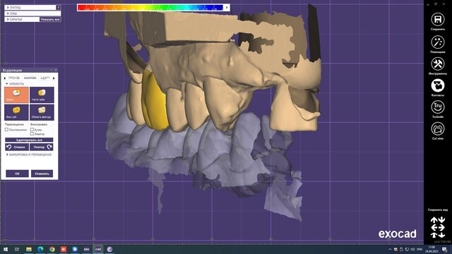I offer professional dental CAD design (Exocad) for crowns, veneers & implants image 6
