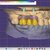 I offer professional dental CAD design (Exocad) for crowns, veneers & implants slider nav image 1