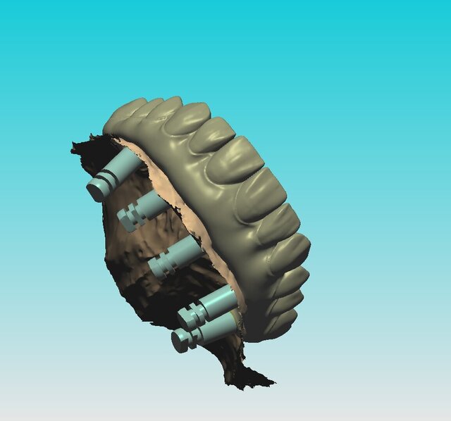 I offer dental cad freelance designing services image 2