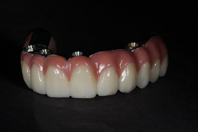 I offer dental cad freelance designing services image 6