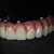 I offer dental cad freelance designing services slider nav image 6