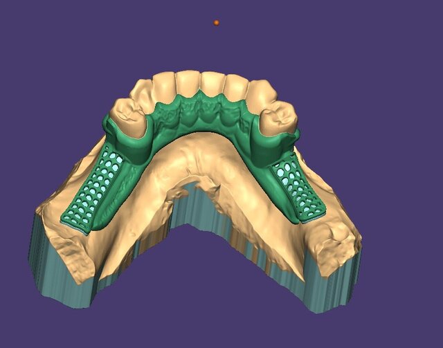 I offer dental cad freelance designing services image 5