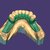I offer dental cad freelance designing services slider nav image 5