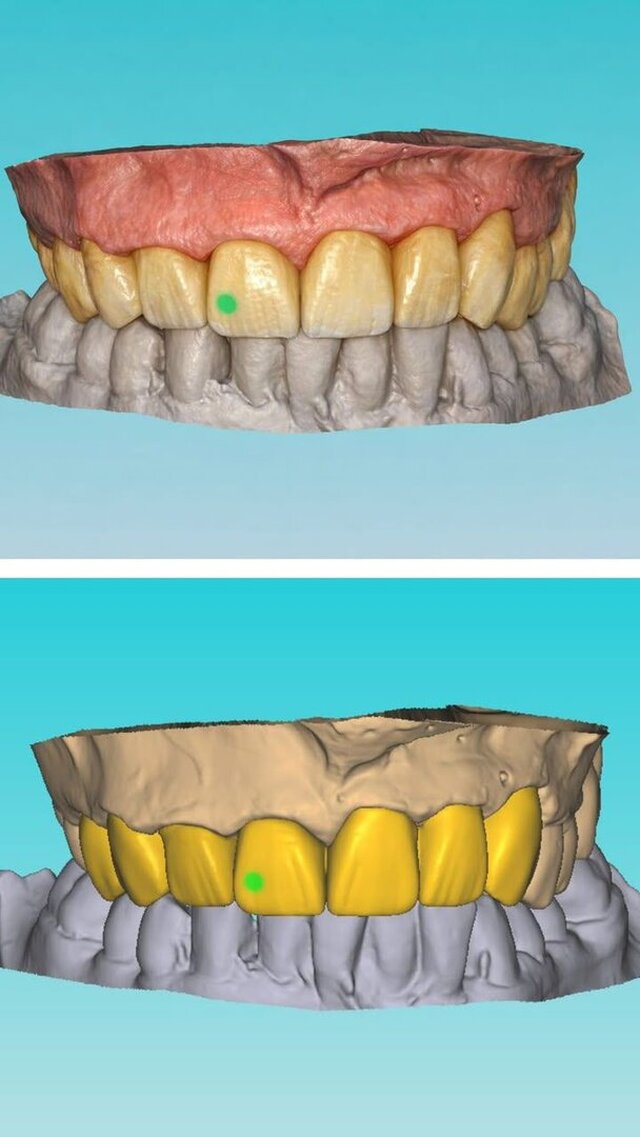 I offer dental cad freelance designing services image 4
