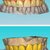 I offer dental cad freelance designing services slider nav image 4