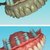 I offer dental cad freelance designing services slider nav image 1