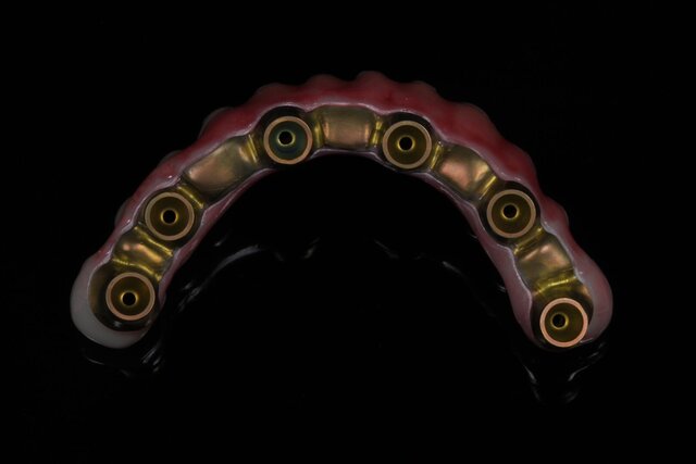 I offer dental cad freelance designing services image 8