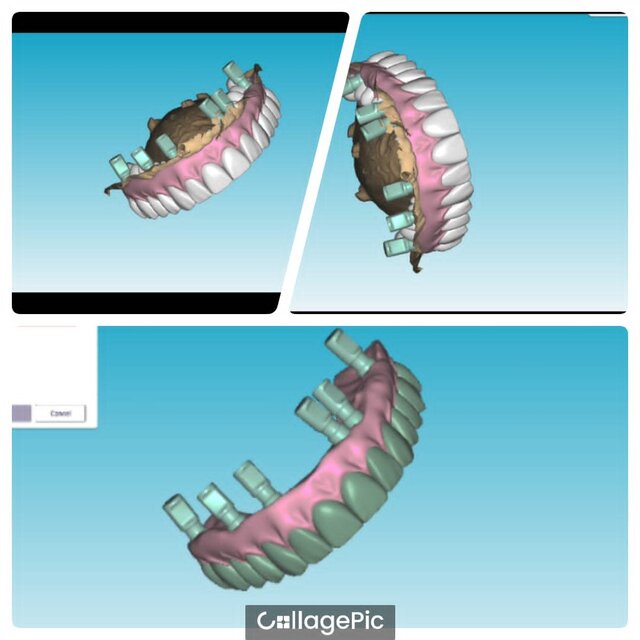 I offer dental cad freelance designing services image 7