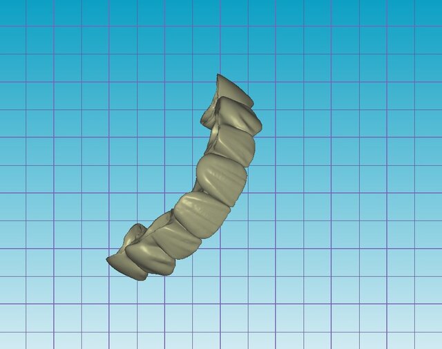 I offer dental cad freelance designing services image 9