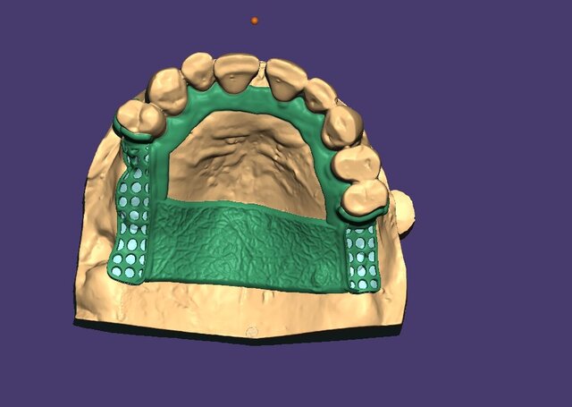 I offer dental cad freelance designing services image 3