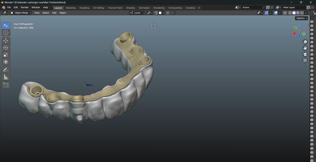 I will design professional Exocad dental restorations, implant cases and full arch workflows image 13