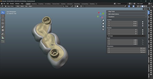 I will design professional Exocad dental restorations, implant cases and full arch workflows image 17