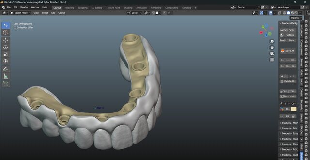 I will design professional Exocad dental restorations, implant cases and full arch workflows image 16