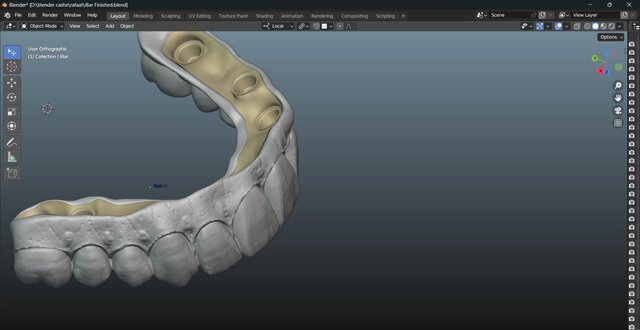 I will design professional Exocad dental restorations, implant cases and full arch workflows image 18