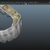 I will design professional Exocad dental restorations, implant cases and full arch workflows slider nav image 18