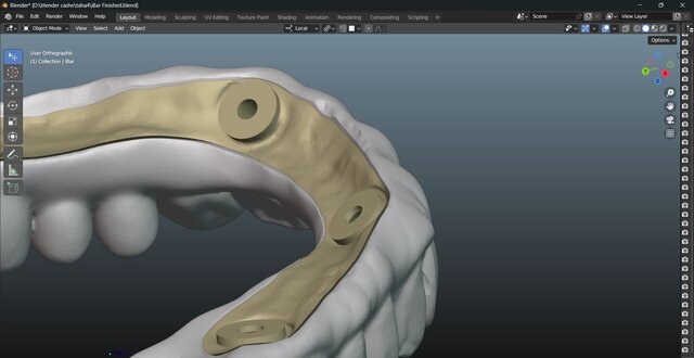 I will design professional Exocad dental restorations, implant cases and full arch workflows image 20