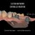 I will design professional Exocad dental restorations, implant cases and full arch workflows slider nav image 3