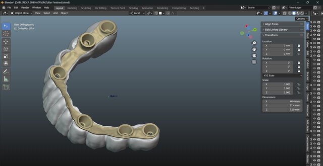 I will design professional Exocad dental restorations, implant cases and full arch workflows image 19