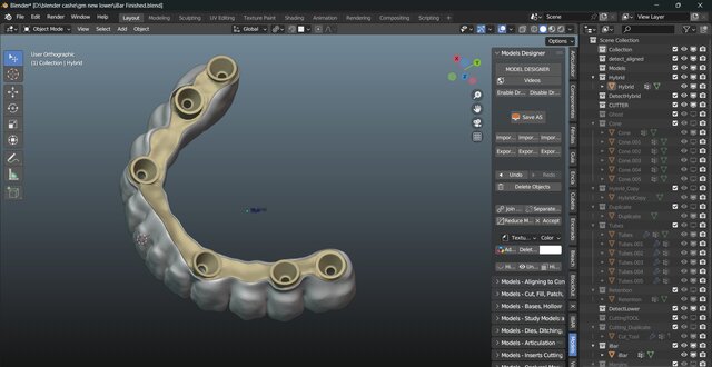 I will design professional Exocad dental restorations, implant cases and full arch workflows image 21